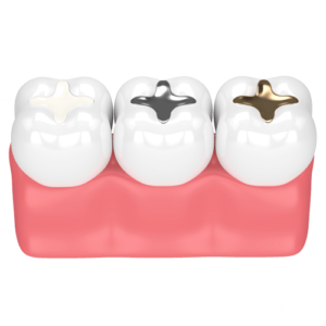 Gundersen Dental is your choice for a dentist in Tumwater, WA. Cavity Fillings